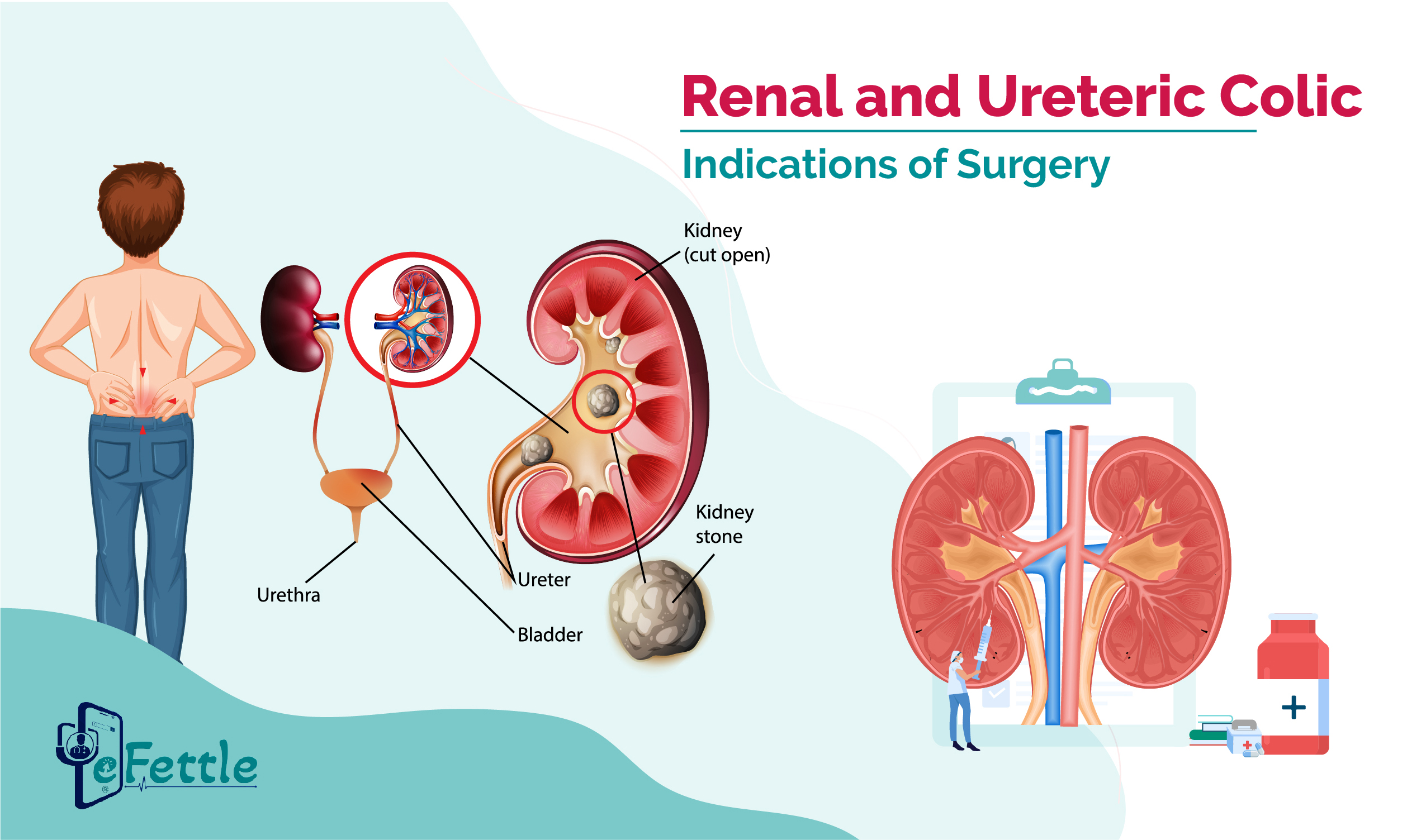 Renal and ureteric colic