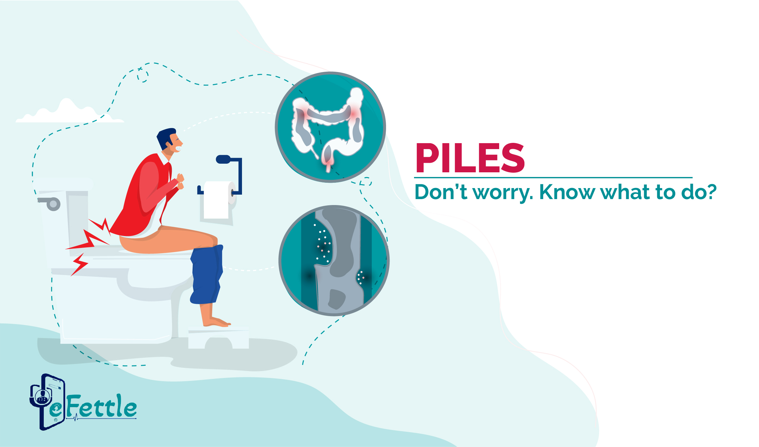 Piles