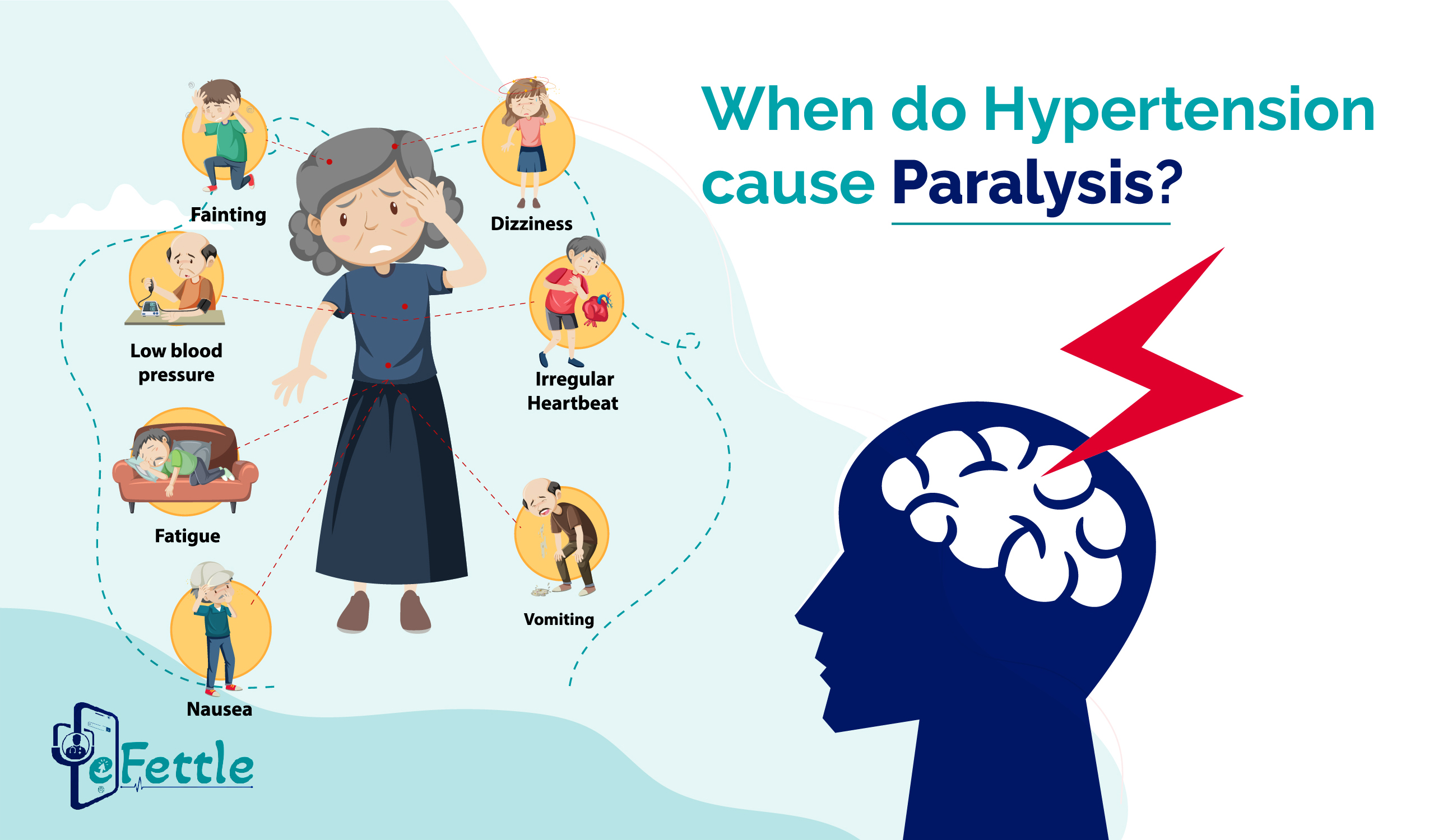 When do Hypertension cause paralysis