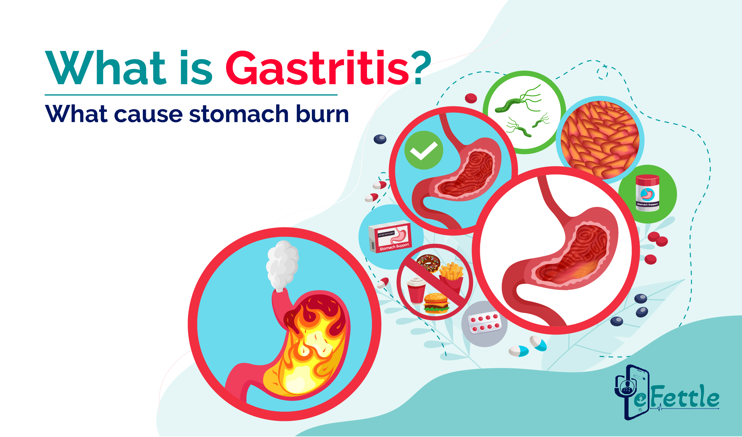 What is Gastritis-Why there be acidity